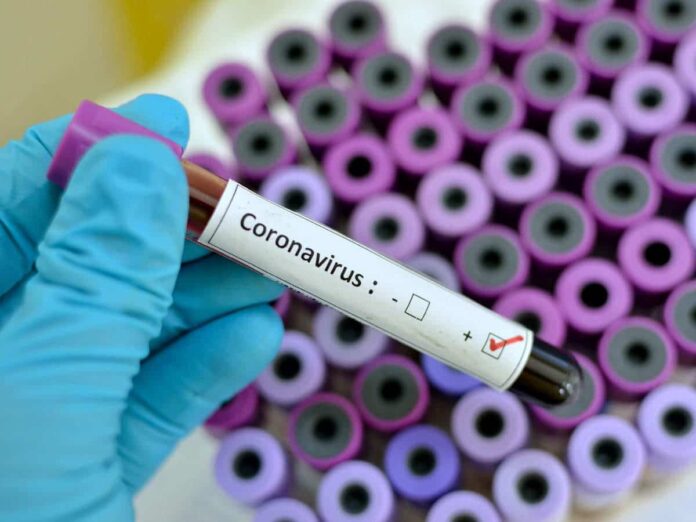 Coronavirus-1